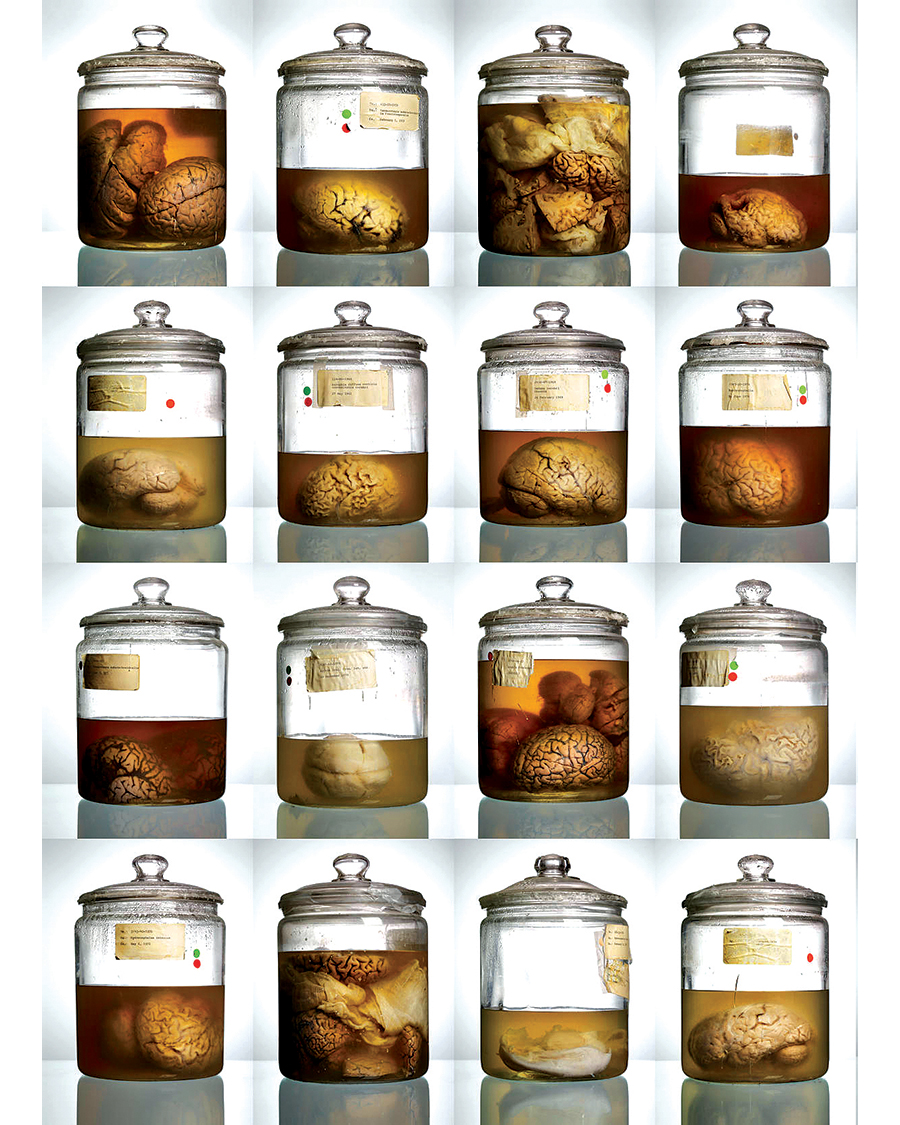 Malformed Brains Web