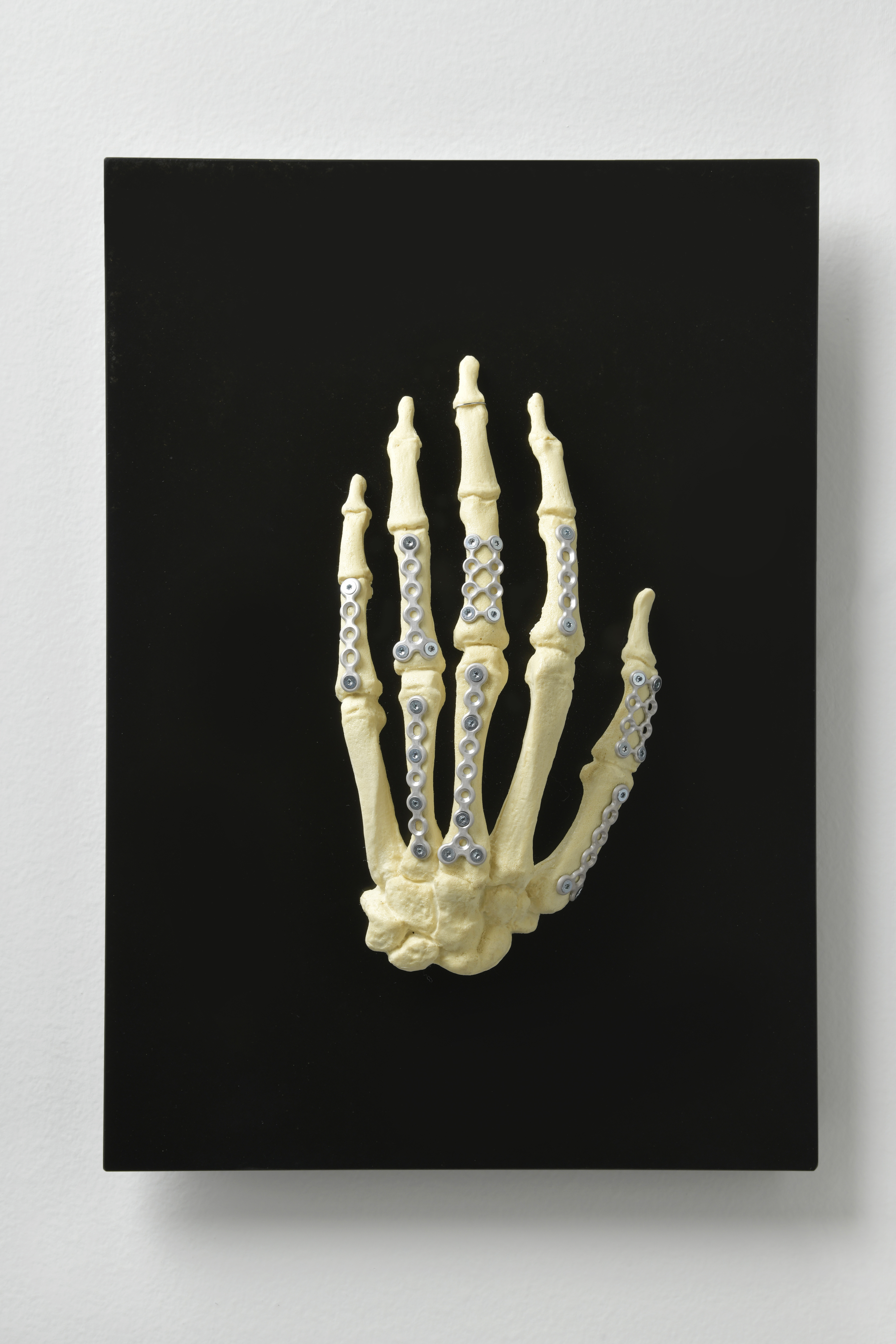 ADF21   ETH Zurich   Implant And Forget   Bone Implants Made Of The World’s Purest Magnesium